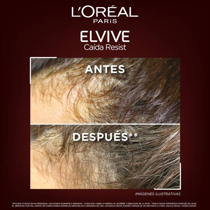 Resultados del Sérum Aminexil Perú. Antes y Después: Cabello más denso y cuero cabelludo menos visible